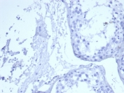 Negative control: IHC staining of FFPE human testis tissue with recombinant EGF Receptor antibody (clone rEGFR/6389) at 2ug/ml in PBS for 30min RT. HIER: boil tissue sections in pH 9 10mM Tris with 1mM EDTA for 20 min and allow to cool before testing.