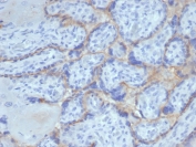 IHC staining of FFPE human placental tissue with recombinant EGF Receptor antibody (clone rEGFR/6389). HIER: boil tissue sections in pH 9 10mM Tris with 1mM EDTA for 20 min and allow to cool before testing.