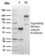 SDS-PAGE analysis of purified, BSA-free recombinant EGFR antibody (clone EGFR/6390R) as confirmation of integrity and purity.