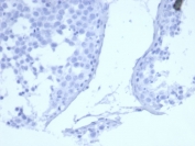 Negative control: IHC staining of FFPE human testis tissue with recombinant EGFR antibody (EGFR/6390R) at 2ug/ml in PBS for 30min RT. HIER: boil tissue sections in pH 9 10mM Tris with 1mM EDTA for 20 min and allow to cool before testing.