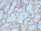 IHC staining of FFPE human placental tissue with recombinant EGFR antibody (clone EGFR/6390R). HIER: boil tissue sections in pH 9 10mM Tris with 1mM EDTA for 20 min and allow to cool before testing.