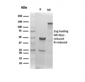 SDS-PAGE analysis of purified, BSA-free recombinant Albumin antibody (clone ALB/6409R) as confirmation of integrity and purity.