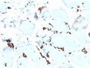 IHC staining of FFPE human esophagus tissue with recombinant FABP5 antibody (clone rFABP5/6354). HIER: boil tissue sections in pH 9 10mM Tris with 1mM EDTA for 20 min and allow to cool before testing.
