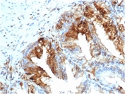 IHC staining of FFPE human skeletal muscle tissue with recombinant FABP5 antibody (clone rFABP5/6354). HIER: boil tissue sections in pH 9 10mM Tris with 1mM EDTA for 20 min and allow to cool before testing.