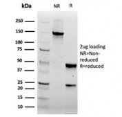 SDS-PAGE analysis of purified, BSA-free recombinant FABP5 antibody (clone rFABP5/6354) as confirmation of integrity and purity.