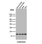Recombinant FABP5 Antibody Cell and Tissue WB. Western blot analysis of human brain, human skin, HeLa, and Raji lysates using FABP5 antibody clone rFABP5/6354. A distinct band is detected at approximately 15 kDa across all tested samples, consistent with the predicted molecular weight of Fatty acid-binding protein 5 / FABP5. The broad expression pattern aligns with the known role of FABP5 in intracellular fatty acid transport, epidermal lipid metabolism, and cellular energy regulation in both epithelial tissues and proliferative cell populations.