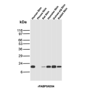 Recombinant FABP5 Antibody Multi-Species Skin WB. Western blot analysis of human skin, mouse skin, rat skin, hamster skin, guinea pig skin, and rabbit skin tissue lysates using FABP5 antibody clone rFABP5/6354. A band is detected at approximately 15 kDa across multiple species, consistent with the predicted molecular weight of Fatty acid-binding protein 5 / FABP5. The conserved skin expression pattern supports the established role of FABP5 in epidermal lipid transport, keratinocyte metabolism, and cutaneous barrier-associated fatty acid signaling pathways.