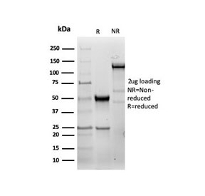 SDS-PAGE analysis of purified, BSA-free recombinant HSP27 antibody (clone HSPB1/6490R) as confirmation of integrity and purity.