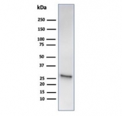 Western blot testing of human liver tissue lysate using recombinant HSP27 antibody (clone HSPB1/6490R). Predicted molecular weight: 23-27 kDa.