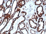 IHC staining of FFPE human liver tissue with recombinant HSP60 antibody (clone HSPD1/6496R). HIER: boil tissue sections in pH 9 10mM Tris with 1mM EDTA for 20 min and allow to cool before testing.