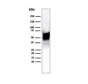 Western blot testing of human Hep2 cell lysate using recombinant HSP60 antibody (clone HSPD1/6496R). Predicted molecular weight: ~60 kDa.~