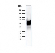 Western blot testing of human Hep2 cell lysate using recombinant HSP60 antibody (clone HSPD1/6496R). Predicted molecular weight: ~60 kDa.