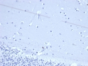 Negative control: IHC staining of FFPE human brain tissue using recombinant TACSTD2 antibody (clone rTACSTD2/6397) at 2ug/ml in PBS for 30min RT. HIER: boil tissue sections in pH 9 10mM Tris with 1mM EDTA for 20 min and allow to cool before testing.