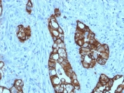 IHC staining of FFPE human colon tissue with recombinant TACSTD2 antibody (clone rTACSTD2/6397). HIER: boil tissue sections in pH 9 10mM Tris with 1mM EDTA for 20 min and allow to cool before testing.