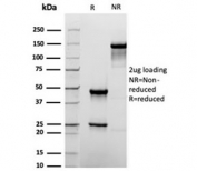 SDS-PAGE analysis of purified, BSA-free recombinant TACSTD2 antibody (clone rTACSTD2/6397) as confirmation of integrity and purity.