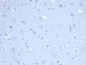 Negative control: IHC staining of FFPE human brain tissue using recombinant Ki-67 antibody (clone MKI67/6517R) at 2ug/ml in PBS for 30min RT. HIER: boil tissue sections in pH 9 10mM Tris with 1mM EDTA for 20 min and allow to cool before testing.