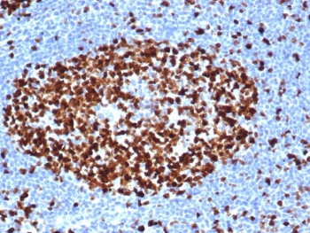 IHC staining of FFPE human tonsil tissue with recombinant Ki-67 antibody (clone MKI67/6517R). HIER: boil tissue sections in pH 9 10mM Tris with 1mM EDTA for 20 min and allow to cool before testing.~