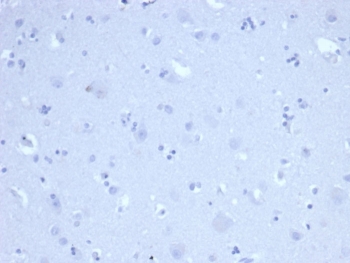 Negative control: IHC staining of FFPE
