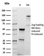 SDS-PAGE analysis of purified, BSA-free recombinant TPO antibody (clone TPO/6417R) as confirmation of integrity and purity.