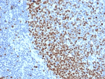 IHC staining of FFPE human tonsil tissue with recombinant Ki67 antibody (clone rMKI67/6615). HIER: boil tissue sections in pH 9 10mM Tris with 1mM EDTA for 20 min and allow to cool before testing.