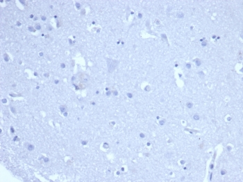 Negative control: IHC staining of FFPE human brain tissue with recombinant Ki67 antibody (clone rMKI67/6615) at 2ug/ml in PBS for 30min RT. HIER: boil tissue sections in pH 9 10mM Tris with 1mM EDTA for 20 min and allow to cool before testing.