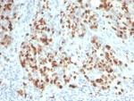 IHC staining of FFPE human lymph node with recombinant Ki67 antibody (clone rMKI67/6615). HIER: boil tissue sections in pH 9 10mM Tris with 1mM EDTA for 20 min and allow to cool before testing.