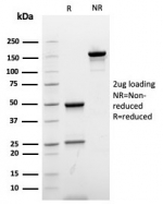 SDS-PAGE analysis of purified, BSA-free recombinant Ki67 antibody (clone rMKI67/6615) as confirmation of integrity and purity.