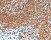 IHC staining of FFPE human tonsil tissue with recombinant Vimentin antibody (clone VIM/6430R). HIER: boil tissue sections in pH 9 10mM Tris with 1mM EDTA for 20 min and allow to cool before testing.