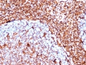 IHC staining of FFPE human tonsil tissue with recombinant Vimentin antibody (clone VIM/6430R). HIER: boil tissue sections in pH 9 10mM Tris with 1mM EDTA for 20 min and allow to cool before testing.