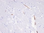 IHC staining of FFPE cow brain tissue with recombinant Vimentin antibody (clone VIM/6430R). HIER: boil tissue sections in pH 9 10mM Tris with 1mM EDTA for 20 min and allow to cool before testing.