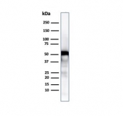 Western blot testing of human U-87 MG cell lysate with recombinant Vimentin antibody. Predicted molecular weight ~53 kDa.
