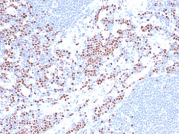 IHC staining of FFPE human lymph node cells (nuclear staining of non-germinal center) using TCF1 alpha antibody (clone LEF1/422R) at 2ug/ml.~