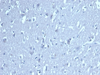 Negative control: IHC staining of human brain tissue with TCF1 alpha antibody at 2ug/ml. HIER: