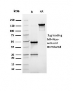 SDS-PAGE analysis of purified, BSA-free recombinant PMEPA1 antibody (clone rPMEPA1/6422) as confirmation of integrity and purity.