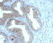IHC staining of FFPE human prostate tissue with recombinant PMEPA1 antibody (clone rPMEPA1/6422). HIER: boil tissue sections in pH 9 10mM Tris with 1mM EDTA for 20 min and allow to cool before testing.