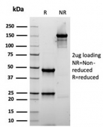 SDS-PAGE analysis of purified, BSA-free Smooth Muscle Actin antibody (rACTA2/1625) as confirmation of integrity and purity.