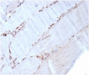 IHC staining of FFPE human skeletal muscle with Smooth Muscle Actin antibody (clone rACTA2/1625). HIER: boil tissue sections in pH 9 10mM Tris with 1mM EDTA for 20 min and allow to cool before testing.