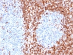 IHC staining of FFPE human tonsil tissue with recombinant Bcl-2 antibody (clone BCL2/6426R). HIER: boil tissue sections in pH 9 10mM Tris with 1mM EDTA for 20 min and allow to cool before testing.