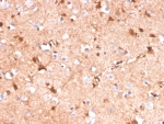 IHC staining of FFPE human cerebellum tissue with S100B antibody (clone S100B/4141). HIER: boil tissue sections in pH 9 10mM Tris with 1mM EDTA for 20 min and allow to cool before testing.