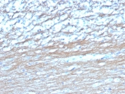 IHC staining of FFPE human cerebellum tissue with PGP9.5 antibody (clone UCHL1/4558). HIER: boil tissue sections in pH 9 10mM Tris with 1mM EDTA for 20 min and allow to cool before testing.