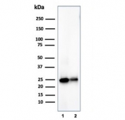Western blot testing of human brain tissue and T98G cell lysates using PGP9.5 antibody (clone UCHL1/4558). Predicted molecular weight ~25 kDa.