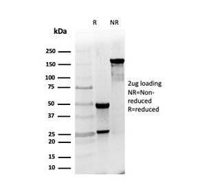 SDS-PAGE analysis of purified, BSA-free PGP9.5 antibody (clone UCHL1/4558) as confirmation of integrity and purity.