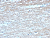 IHC staining of FFPE human cerebellum tissue with PGP9.5 antibody (clone UCHL1/4558). HIER: boil tissue sections in pH 9 10mM Tris with 1mM EDTA for 20 min and allow to cool before testing.