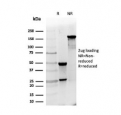 SDS-PAGE analysis of purified, BSA-free PGP9.5 antibody (clone UCHL1/4558) as confirmation of integrity and purity.