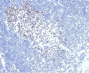 IHC staining of FFPE cat lymph node tissue with recombinant MSH2 antibody (clone rMSH2/6548). HIER: boil tissue sections in pH 9 10mM Tris with 1mM EDTA for 20 min and allow to cool before testing.