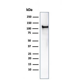 Western blot testing of human HCT-116 cell lysate using recombinant MSH2 antibody (clone rMSH2/6548). Expected molecular weight ~105 kDa.