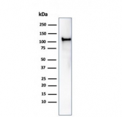 Western blot testing of human HCT-116 cell lysate using recombinant MSH2 antibody (clone rMSH2/6548). Expected molecular weight ~105 kDa.