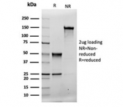 SDS-PAGE analysis of purified, BSA-free recombinant MSH2 antibody (clone rMSH2/6548) as confirmation of integrity and purity.