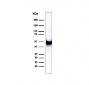 Western blot testing of human U-87 MG cell lysate using recombinant VIM antibody (clone rVIM/6431). Predicted molecular weight ~53 kDa.