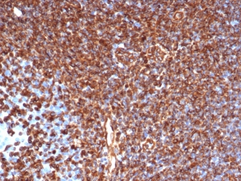 IHC staining of FFPE human tonsil tissue with recombinant VIM antibody (clone rVIM/6431). HIER: boil tissue sections in pH 9 10mM Tris with 1mM EDTA for 20 min and allow to cool before testing.